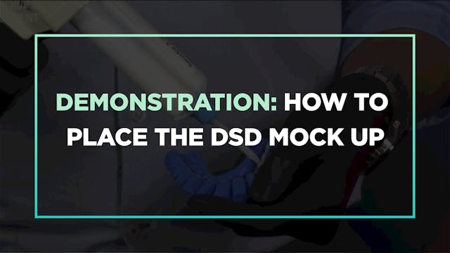 Demonstration: how to place the DSD M...