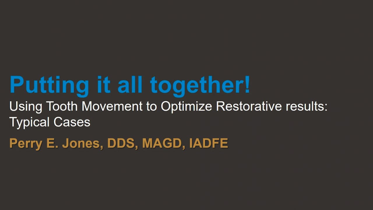 Case review combination cases with tooth movement & prosthodontics