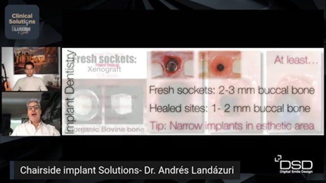 Chairside implant solutions with Dr Andres Landázuri