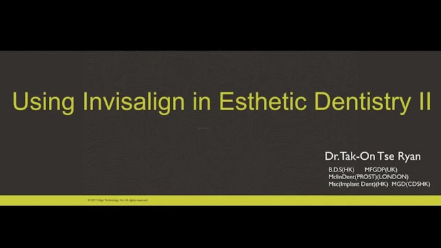 Digital Smile Design – facially driven interdisciplinary cases Part 2 - Ryan Tse