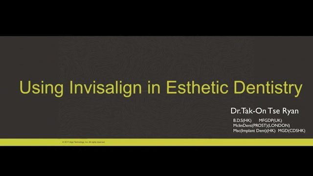 Digital Smile Design – facially driven interdisciplinary cases Part 1 - Ryan Tse