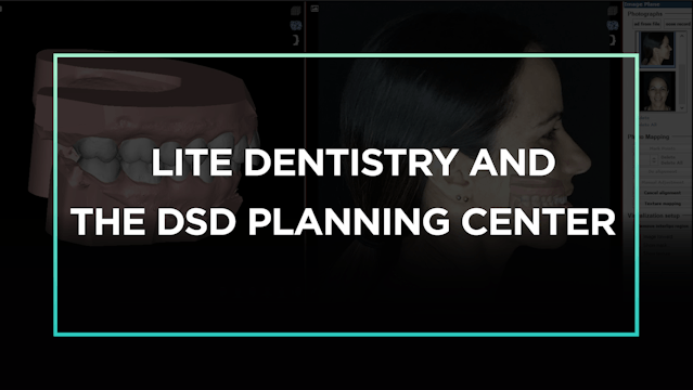 Lite Dentistry and the DSD Planning C...