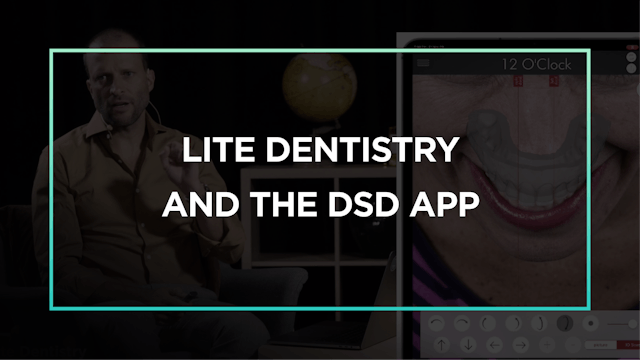 Lite Dentistry and the DSDApp