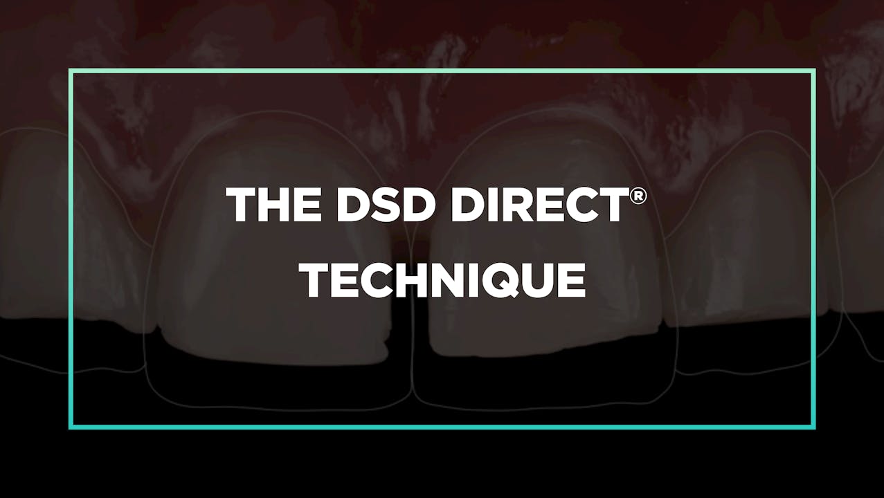 The DSD Direct® Technique DSD Direct Masterclass Watch DSD