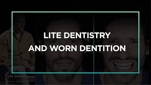 Lite Dentistry and Worn Dentition