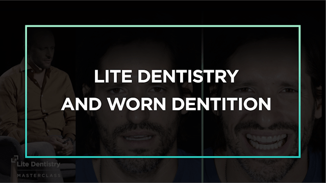 Lite Dentistry and Worn Dentition