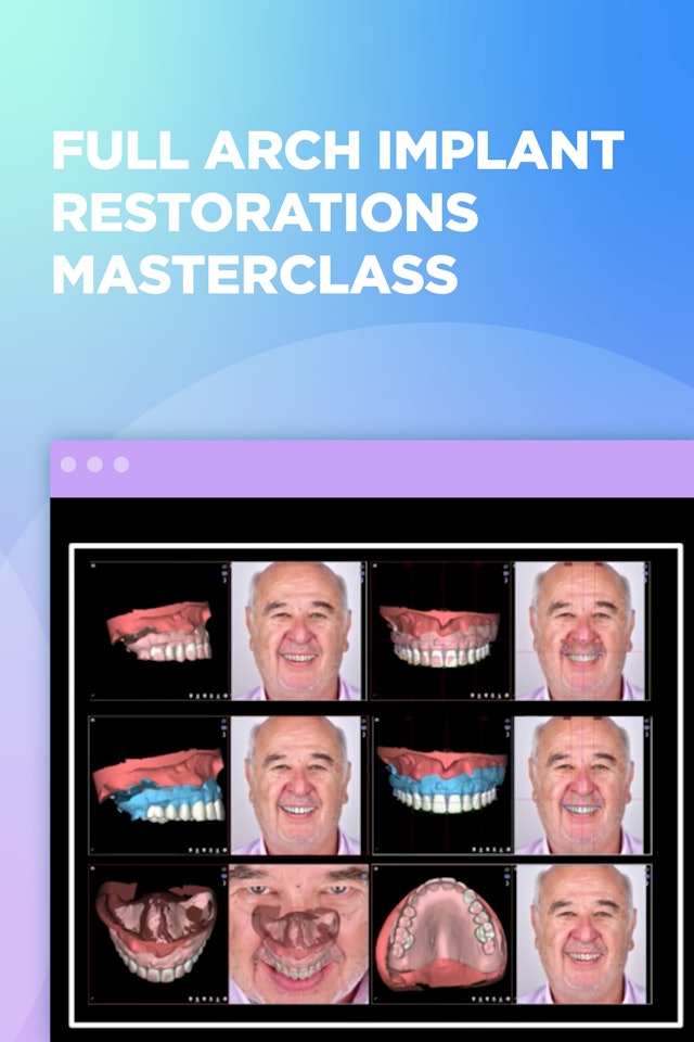 Full Arch Implant Restorations Masterclass