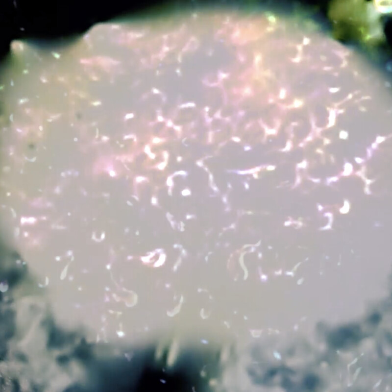 BEATINGS ARE IN THE BODY short film, Music Festival audience (interview)