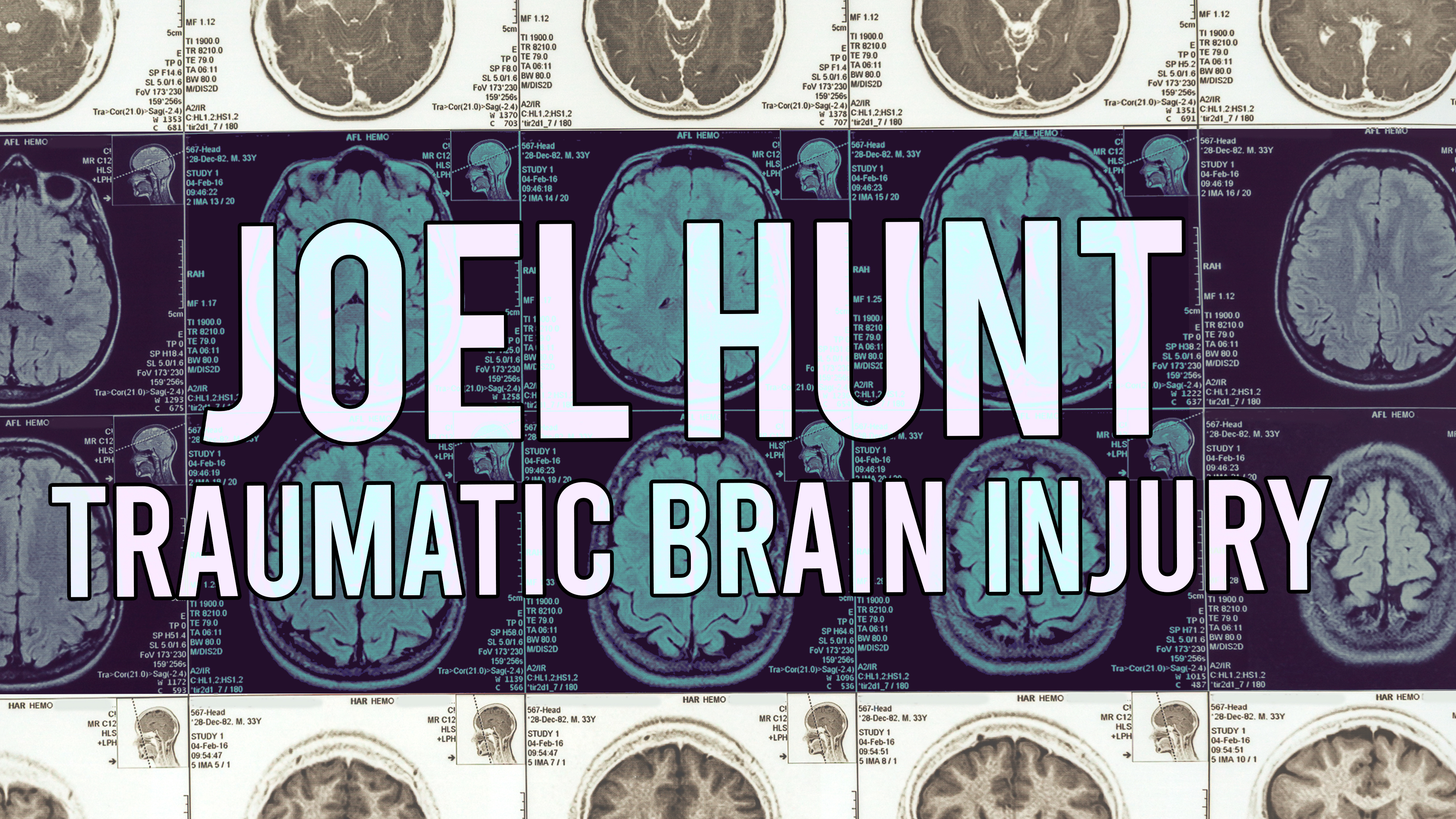 Joel Hunt: Traumatic Brain Injury (TBI)