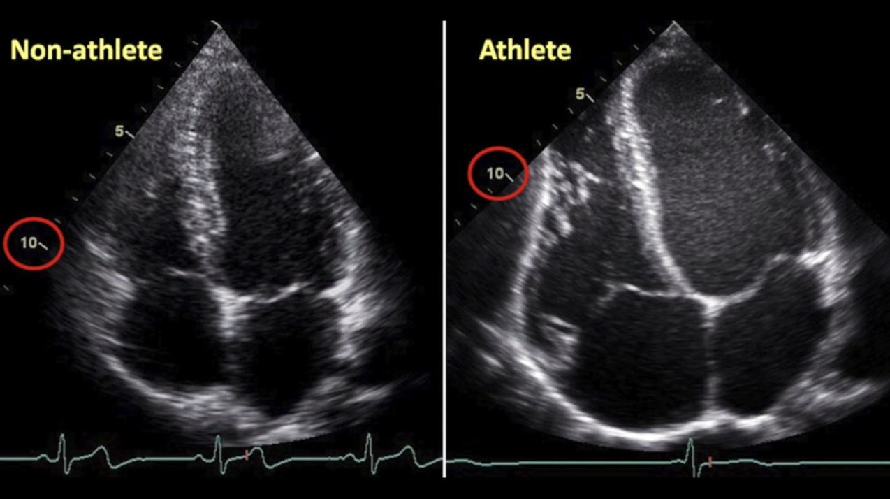 CYCLING | 20 MIN | FULL BODY | HARD | DYNAMIC
