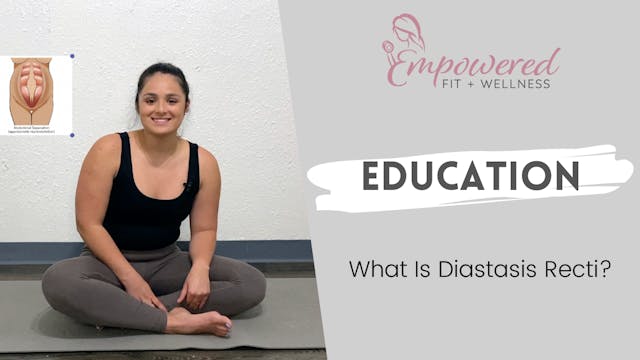 What is Diastasis Recti?