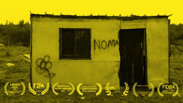 Noma