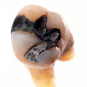 Mercury Risk assessment results, everyone over safe dose