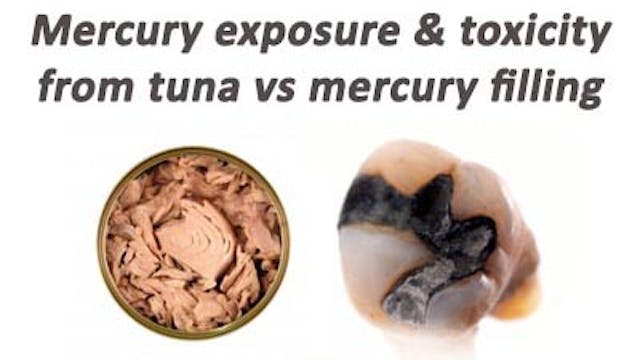 Comparing exposure & risk of mercury in tuna fish vs mercury dental fillings