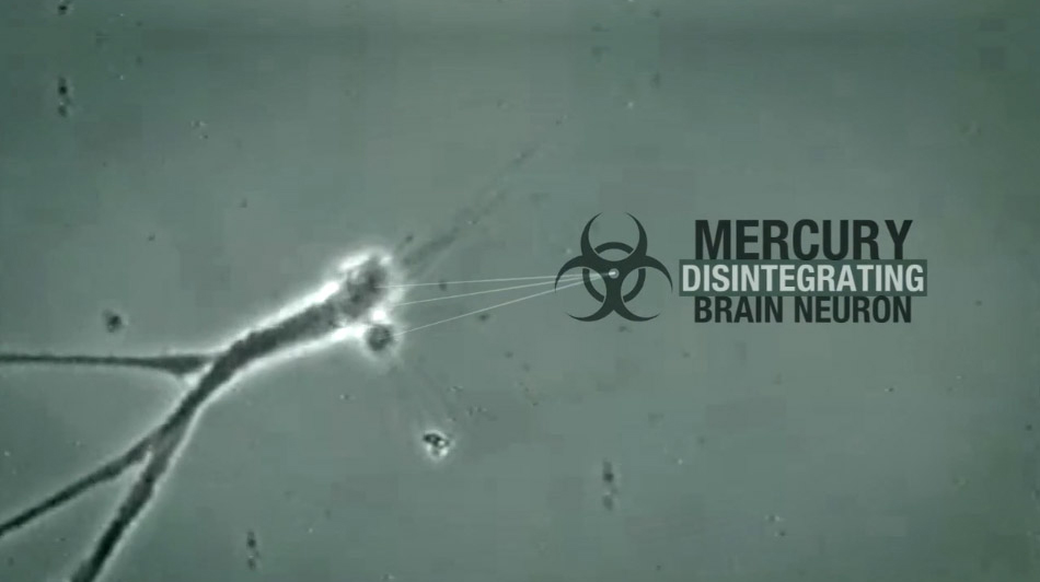 Mercury & Alzheimer's Disease