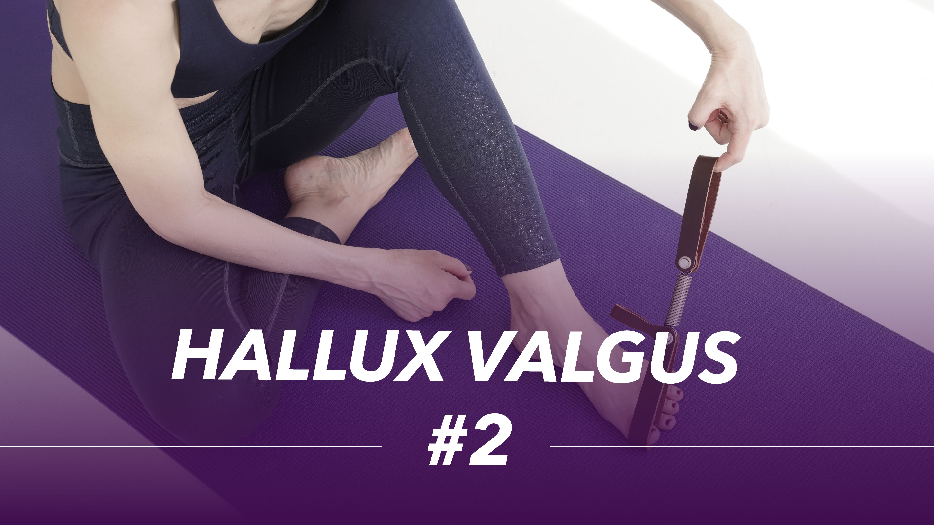 Hallux valugus #2