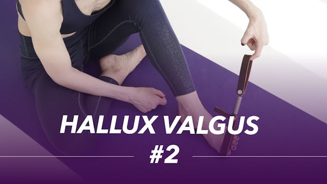 Hallux valugus #2