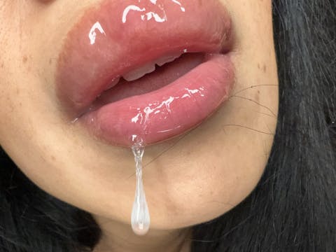 Spit 