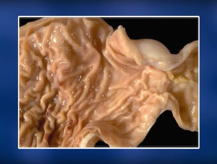 0320 Alcohol The Medical Consequences Part 1