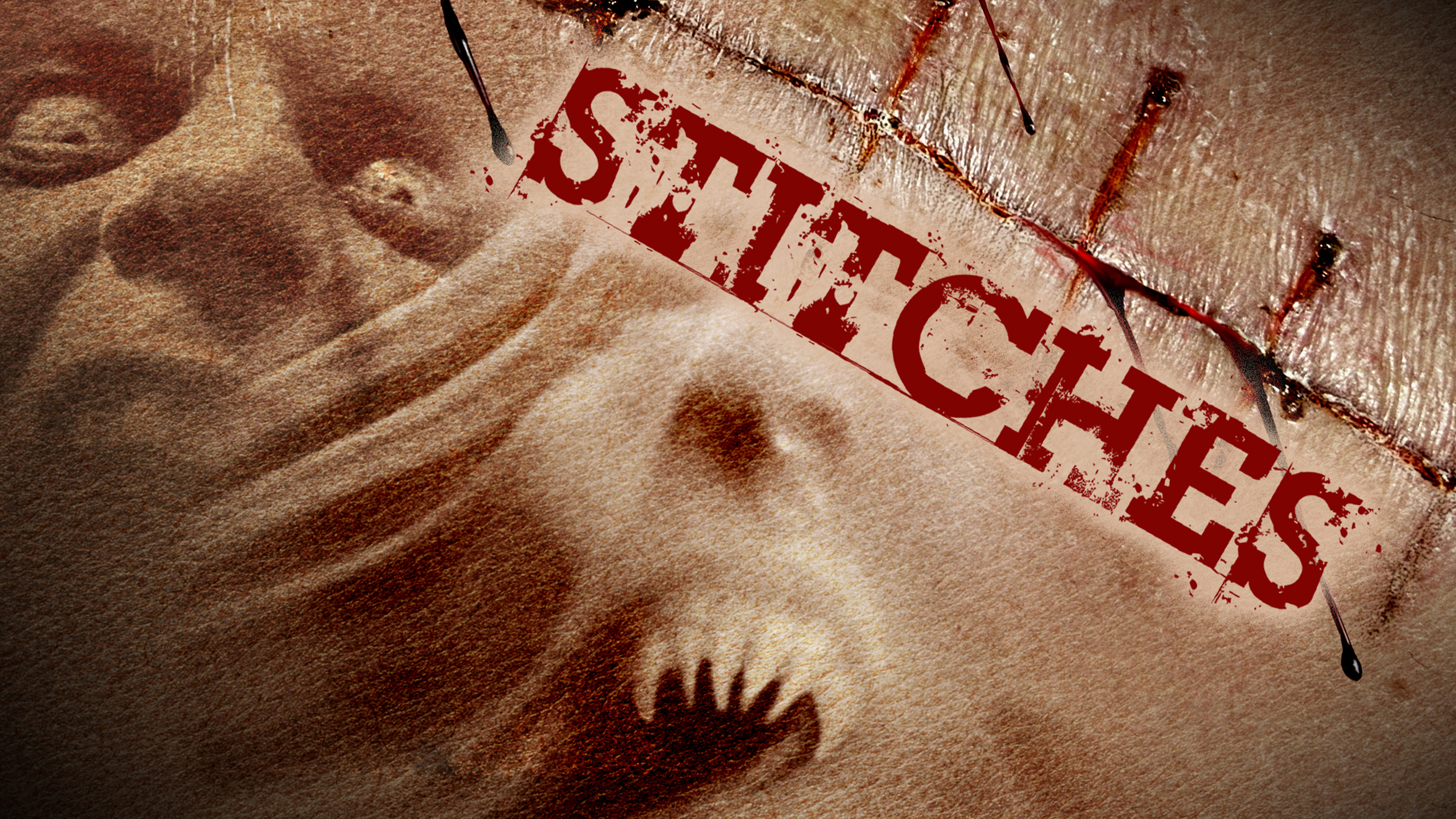 Stitches