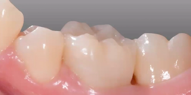 LIVE TREATMENT PLANNING Session and Q&A | Dr Riccardo Ammannato