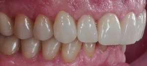 Periodontal Link with Systemic Disease | Ms Karima Bapoo-Mohamed