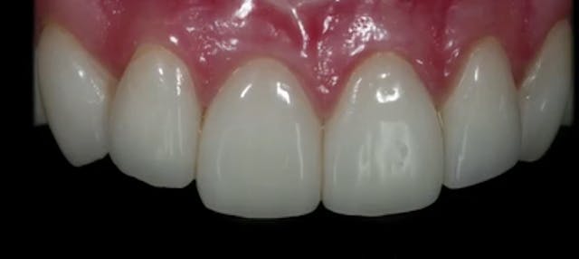 Adhesive & Esthetic Dentistry Minimal...