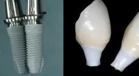 Soft Tissue Esthetics & Health - 10 Key Factors in Soft Tissue Management