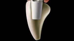 Biological Elements in Achieving Natural Implant Aesthetics (JAPANESE LANGUAGE