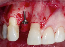 Process of Care 02 | Ms Karima Bapoo-Mohamed