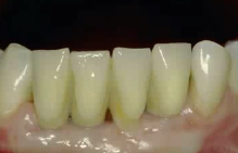 Advanced Implant Surgery: Site Development, Function and Esthetics (ITALIAN LAN