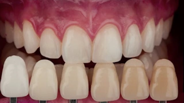 Color in Dentistry - Communication wi...