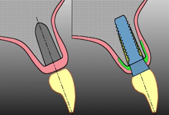 Full Digital Workflow - What has Changed? What will change?