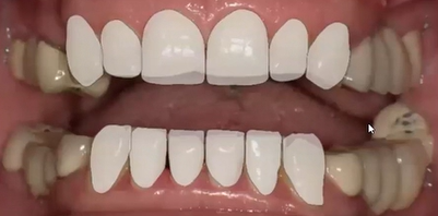 LIVE OFFICE HOURS and Q&A with Mintrone & Fabbri