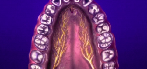 CLINICAL VIDEO The technique steps for harvesting of a palatal free connective