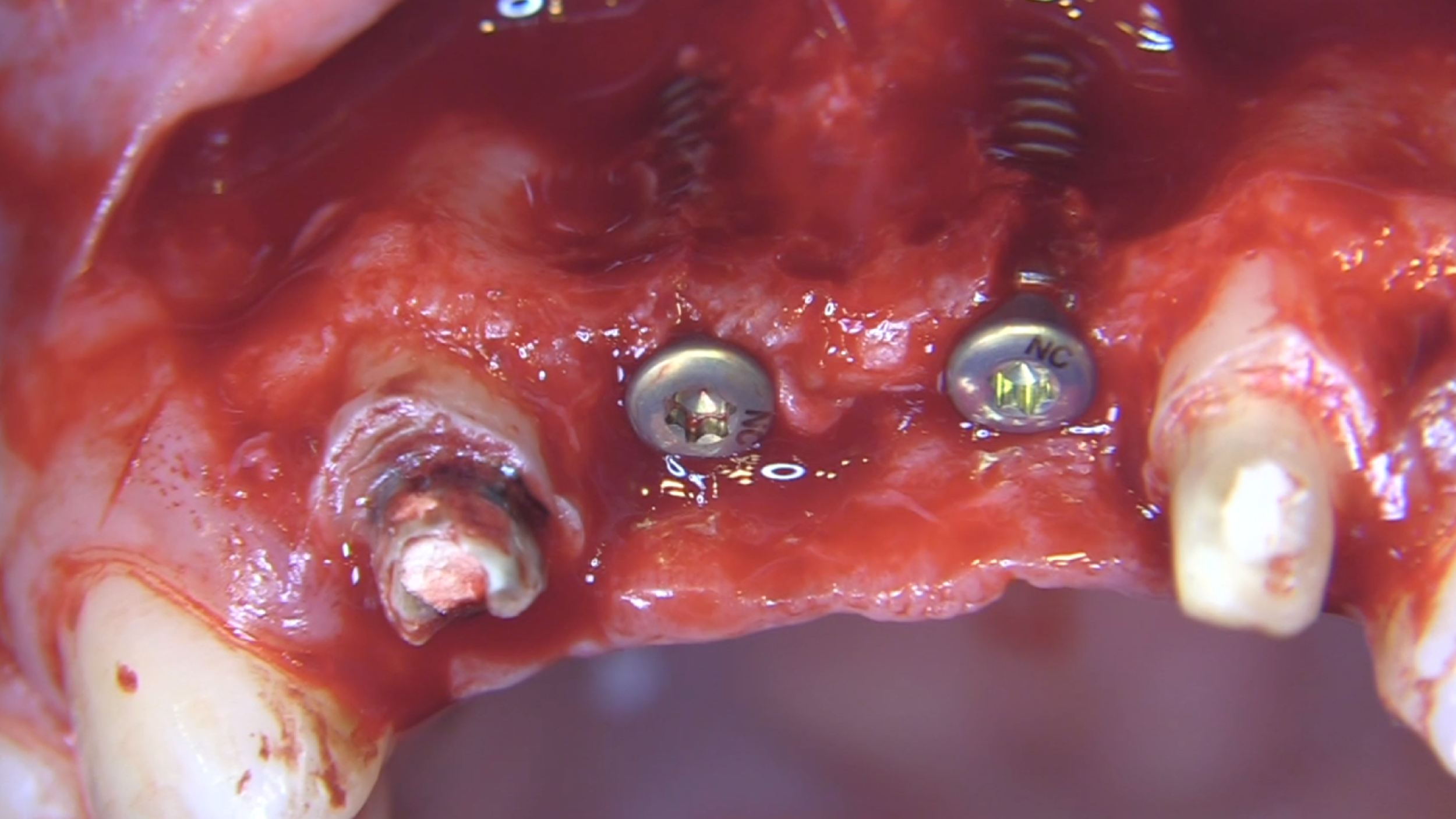 gIDE Dental Institute Video