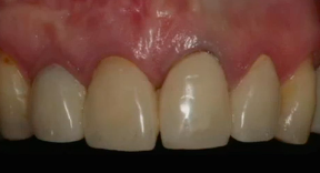 Cirugia Plastica Oral (SPANISH LANGUAGE ONLY)