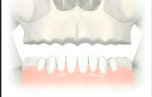 The Graftless Concept - A Systematic Pre-Treatment Evaluation Method for Treatm