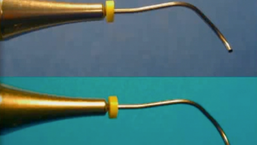 The use of MTA in Clinical and Surgical Endodontics