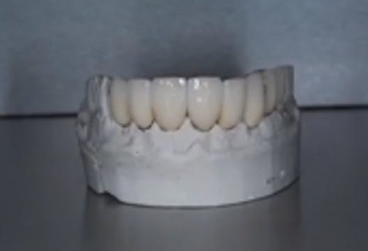Newest Dental Laboratory Techniques i...
