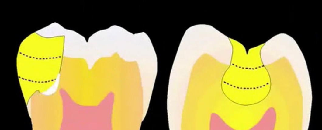 Dental Biochemistry – Role of Biofilm | Ms Karima Bapoo-Mohamed