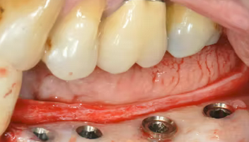 Clinical Results | Dr Marco Ronda