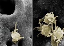 The Biodynamics of Osseointegration Facts and Clinical Implications