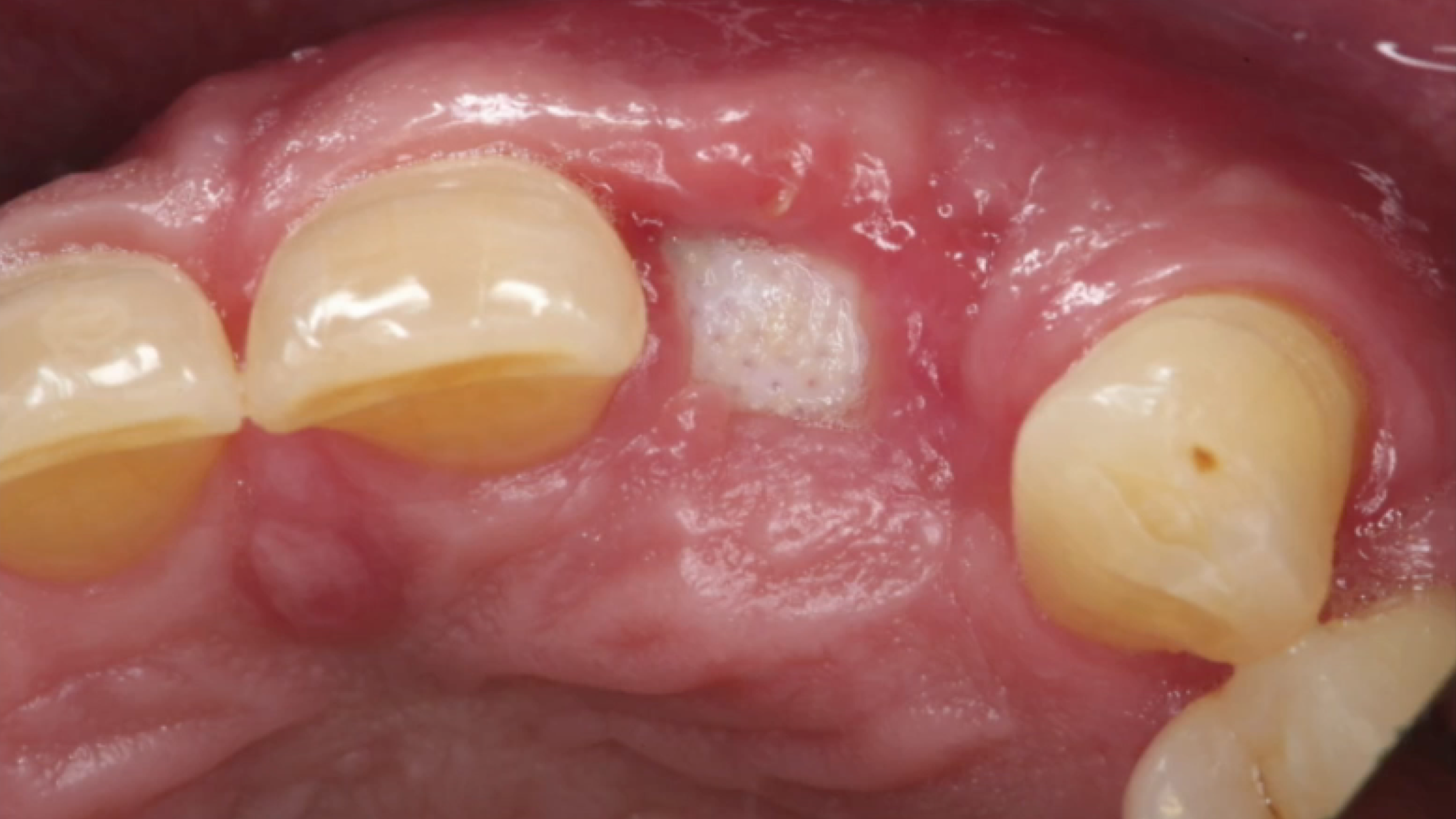 gIDE Dental Institute Video