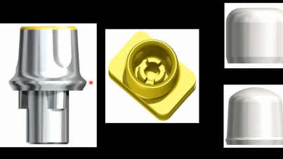 Are Single Tooth Implants Right for Your Practice?