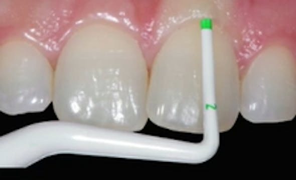 Decision Making in Plastic Esthetic P...