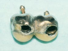 The Diagnosis and Surgical Management of Periimplantitis