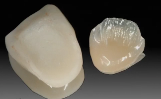 No Post, No Crown: Biomimetic Restorative Dentistry