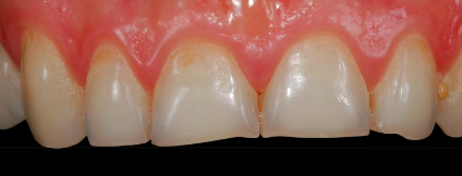 The Esthetic Connection: Smile Design Communication