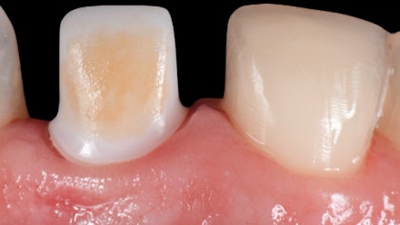 gIDE Dental Institute Video